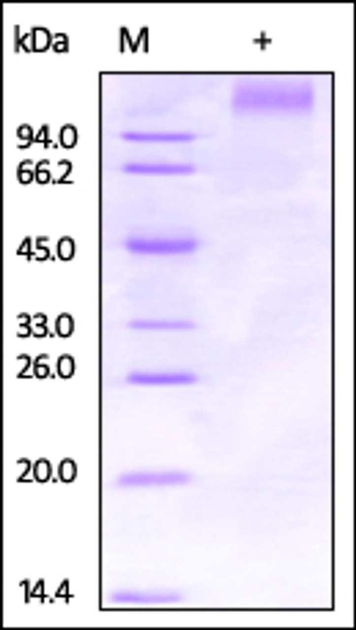 Ebolavirus EBOV (subtype Zaire, strain Kikwit-95) GP1 on SDS-PAGE under reducing (R) condition. The gel was stained overnight with Coomassie Blue. The purity of the protein is greater than 95%.