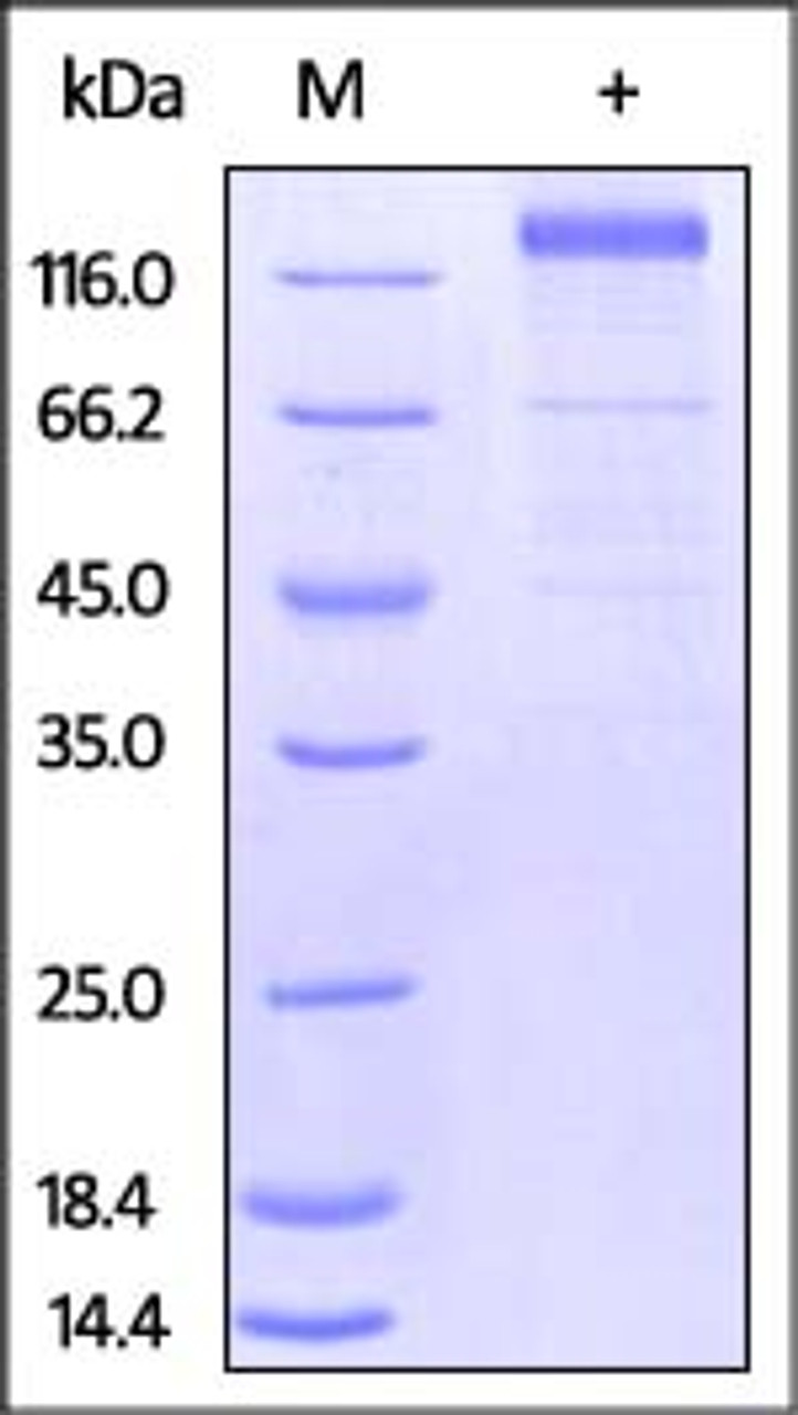 HCMV Glycoprotein B (gB) , Fc Tag on SDS-PAGE under reducing (R) condition. The gel was stained overnight with Coomassie Blue. The purity of the protein is greater than 85%.