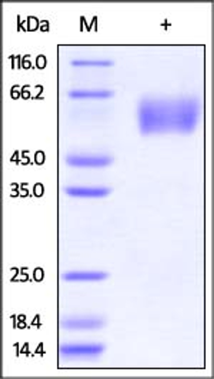 Influenza A [A/Guinea fowl/Hong Kong/WF10/99 (H9N2) ] HA1 on SDS-PAGE under reducing (R) condition. The gel was stained overnight with Coomassie Blue. The purity of the protein is greater than 95%.