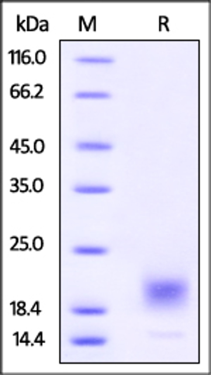 Vibrio cholerae serotype O1 CTXB, His Tag on SDS-PAGE under reducing (R) condition. The gel was stained overnight with Coomassie Blue. The purity of the protein is greater than 92%.