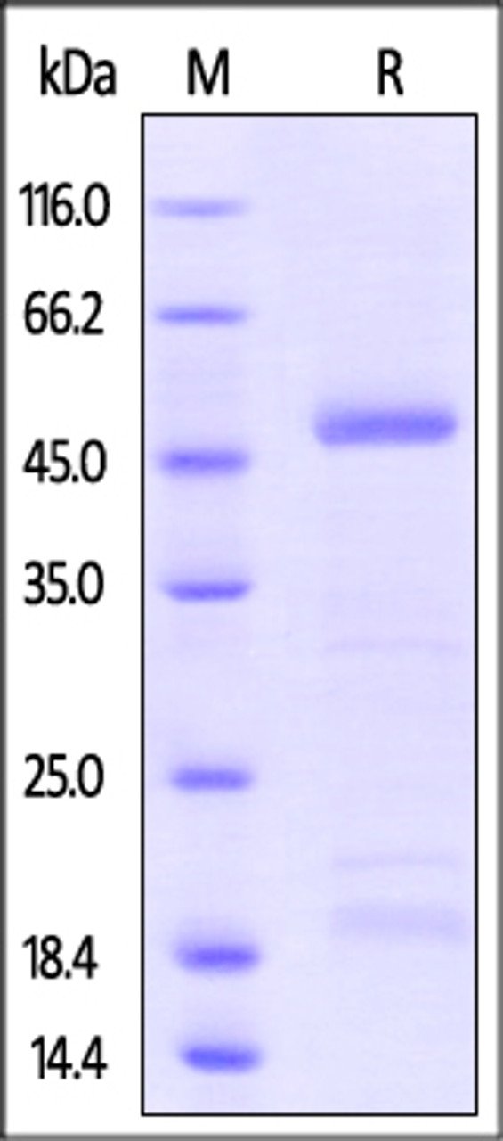 Zika virus NS1, His Tag on SDS-PAGE under reducing (R) condition. The gel was stained overnight with Coomassie Blue. The purity of the protein is greater than 90%.