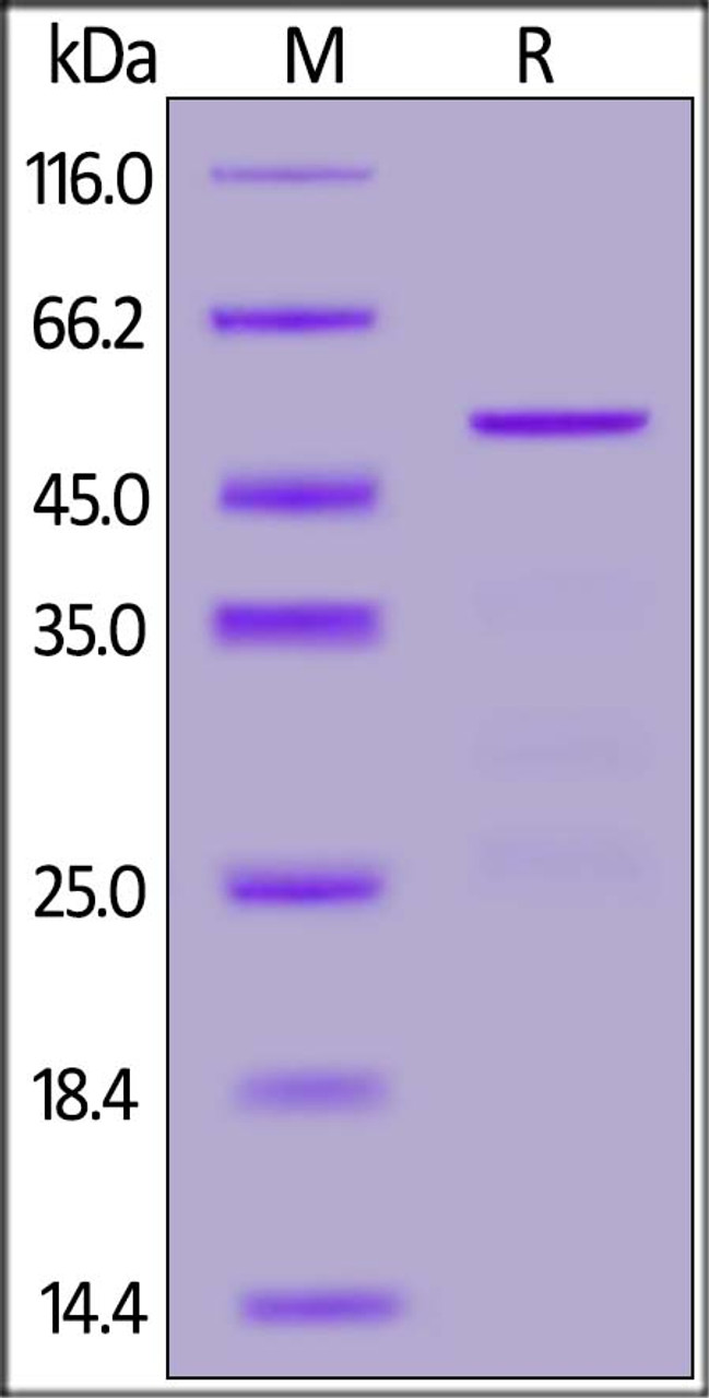 2019-nCoV Nucleocapsid protein, His Tag on SDS-PAGE under reducing (R) condition. The gel was stained overnight with Coomassie Blue. The purity of the protein is greater than 90%.