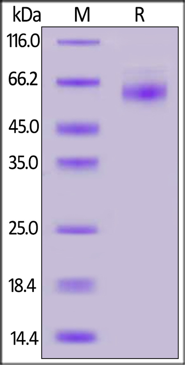 2019-nCoV nucleocapsid recombinant protein on SDS-PAGE under reducing (R) condition. The gel was stained overnight with Coomassie Blue. The purity of the protein is greater than 95%.