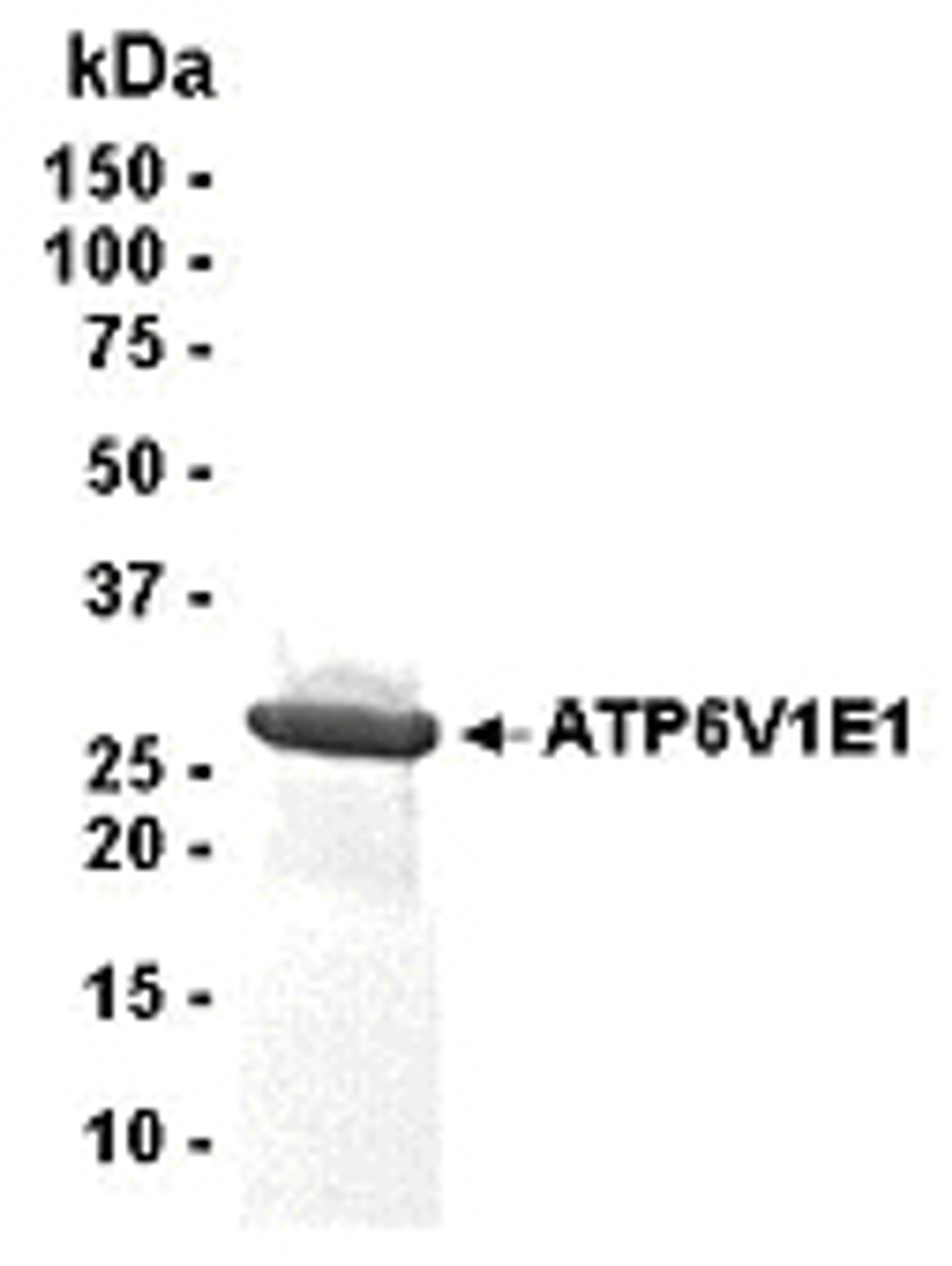 SDS PAGE: Analysis of ATP6V1E1 Recombinant Protein. 4-20% SDS gradient gel. Coomassie blue staining.