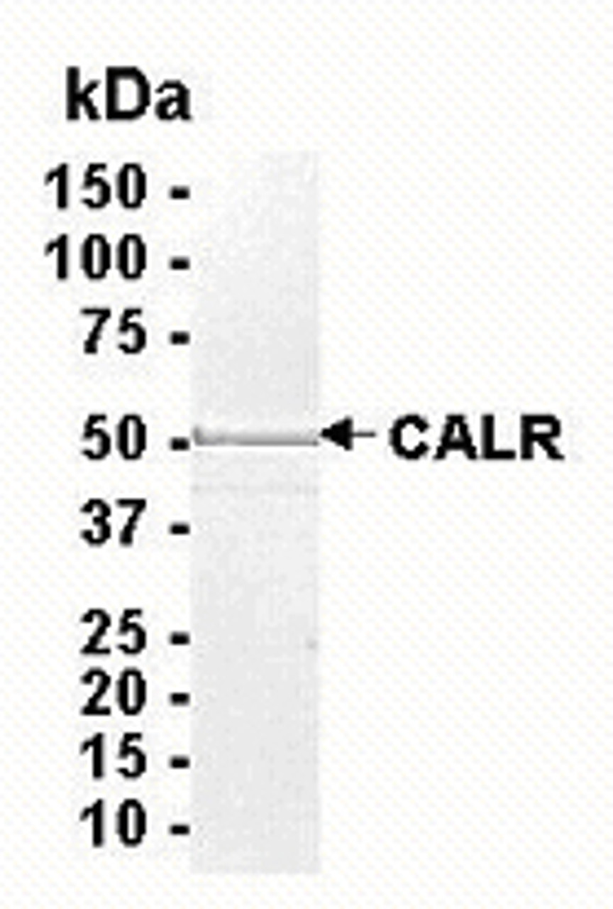 SDS PAGE: Analysis of CALR Recombinant Protein. 4-20% SDS gradient gel. Coomassie blue staining.