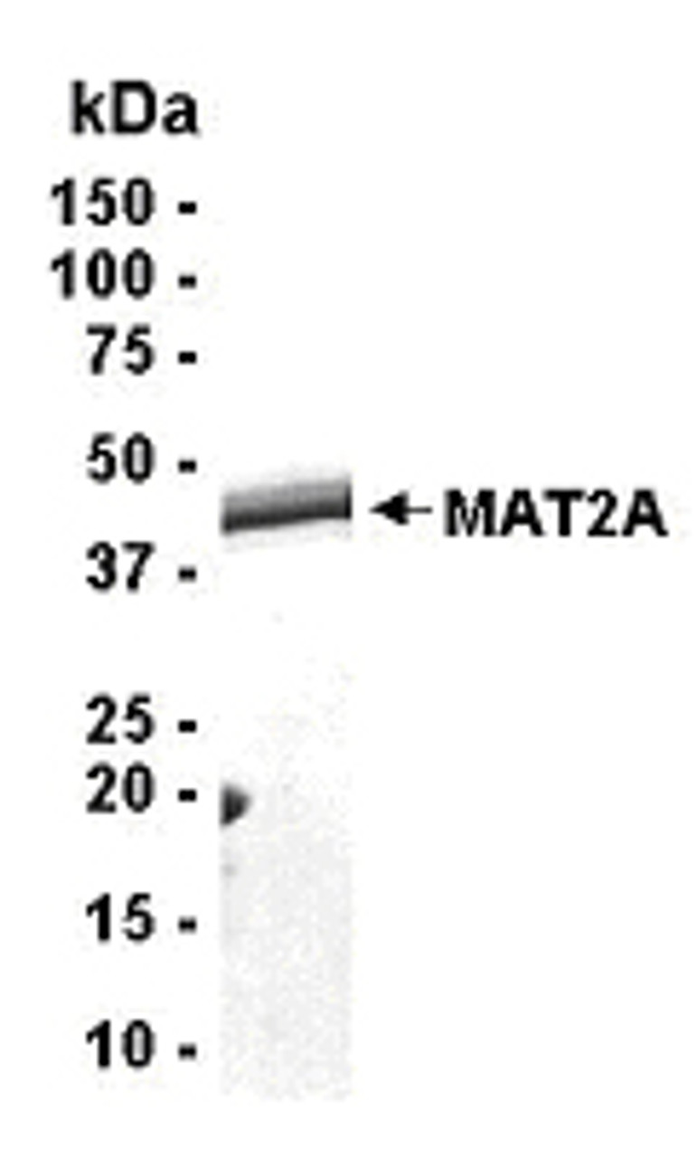 SDS PAGE: Analysis of MAT2A Recombinant Protein. 4-20% SDS gradient gel. Coomassie blue staining.
