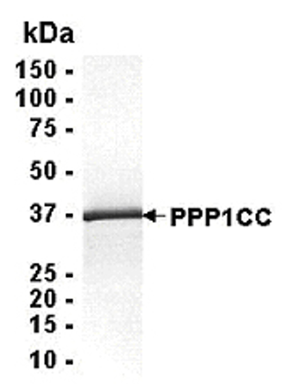 SDS PAGE: Analysis of PPP1CC Recombinant Protein. 4-20% SDS gradient gel. Coomassie blue staining.