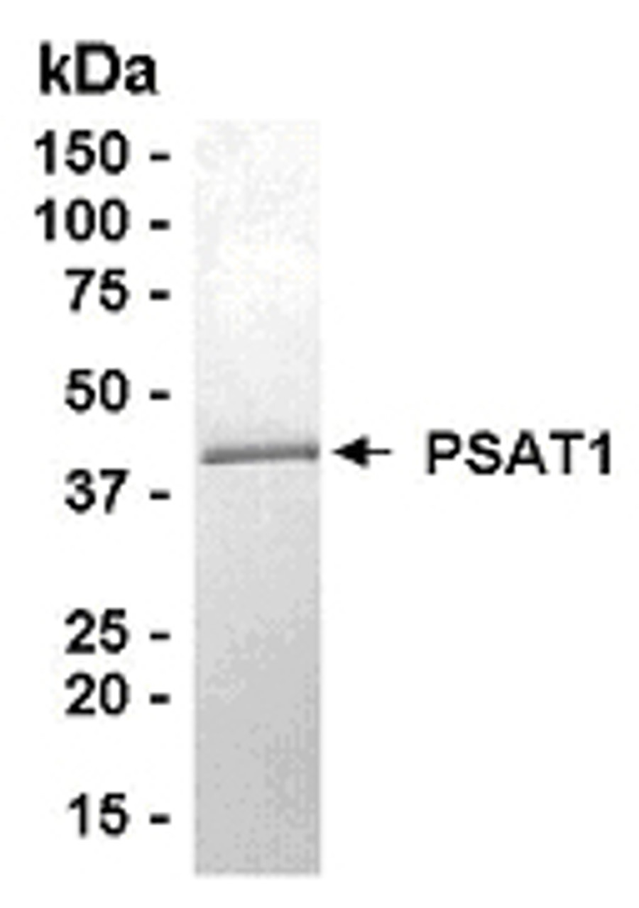 SDS PAGE: Analysis of PSAT1 Recombinant Protein. 4-20% SDS gradient gel. Coomassie blue staining.