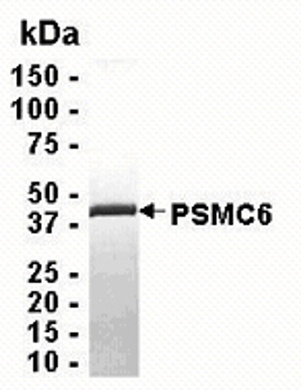 SDS PAGE: Analysis of PSMC6 Recombinant Protein. 4-20% SDS gradient gel. Coomassie blue staining.