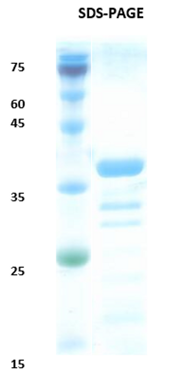 SDS-Page Image