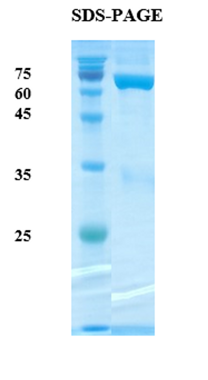 SDS-Page Image