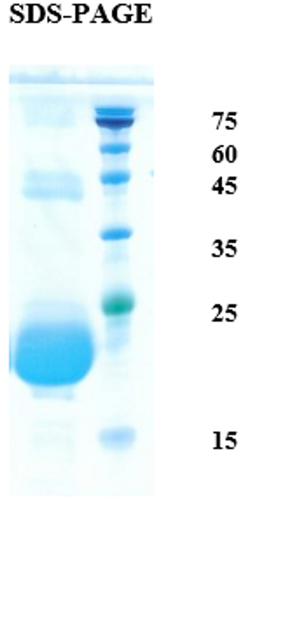 SDS-Page Image