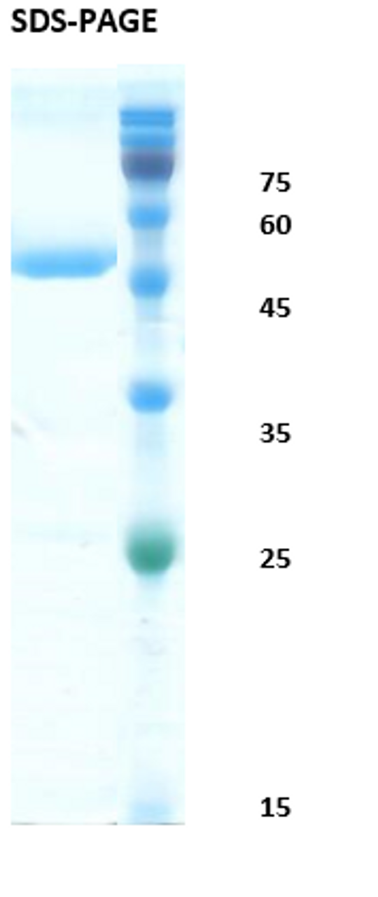 SDS-Page Image