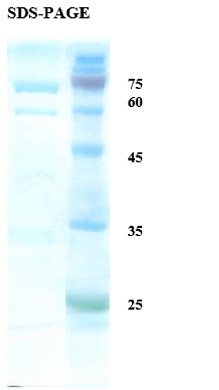 SDS-Page Image