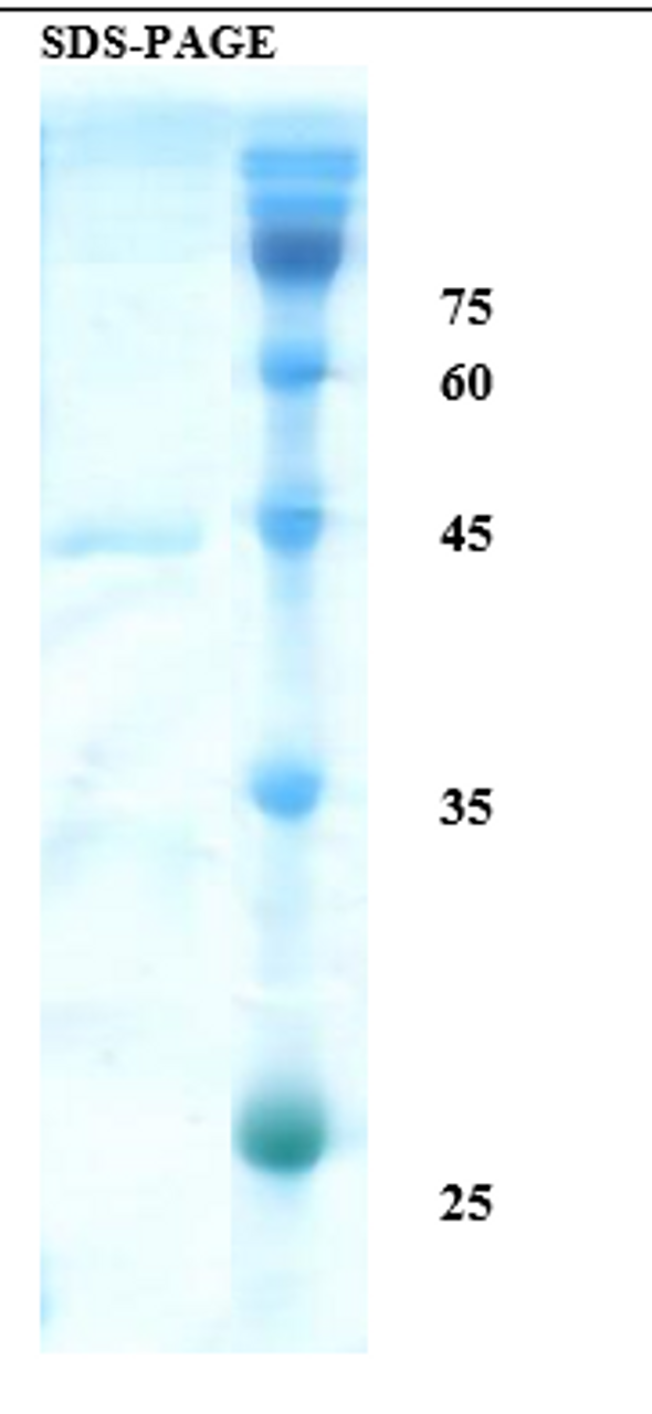 SDS-Page Image