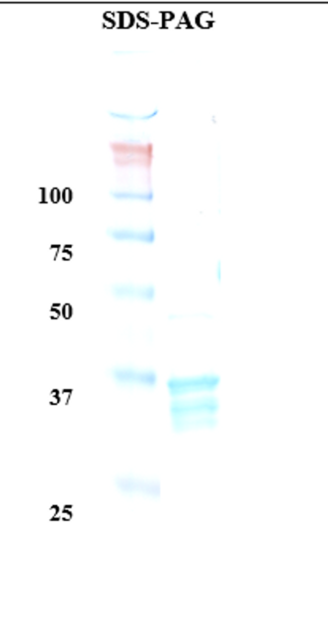 SDS-Page Image