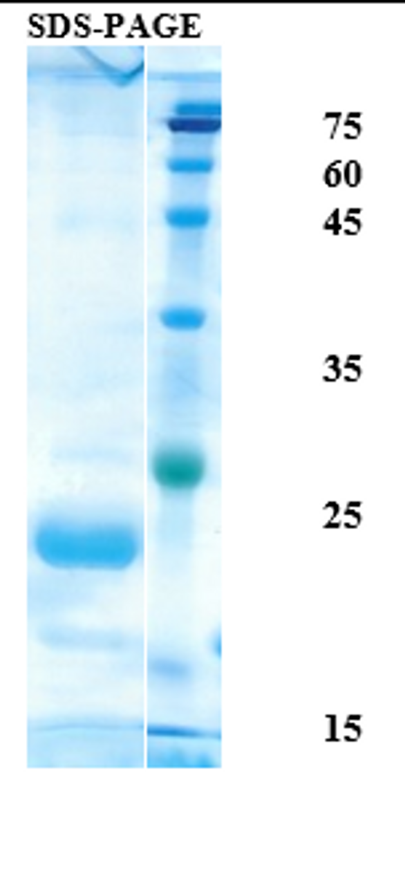 SDS-Page Image