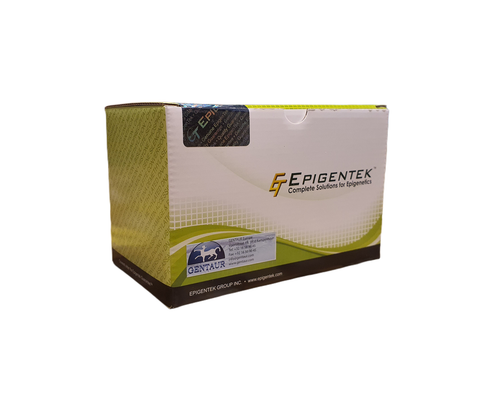 Epigenase LSD1 Demethylase Activity/Inhibition Assay Kit (Fluorometric) | P-3079