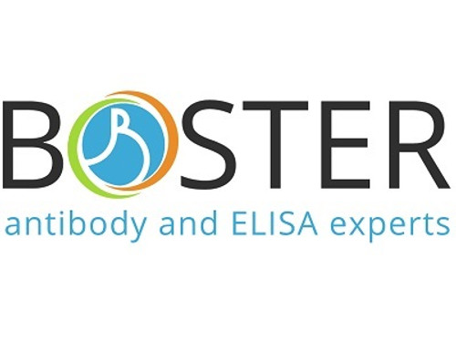 ST5 Colorimetric Cell-Based ELISA