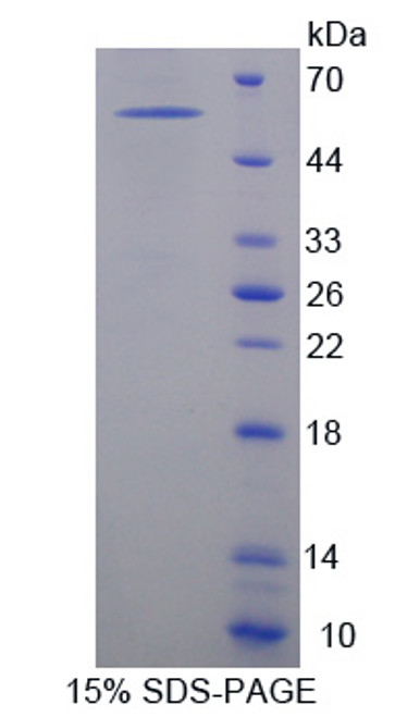 Cattle Recombinant Activated Leukocyte Cell Adhesion Molecule (ALCAM)