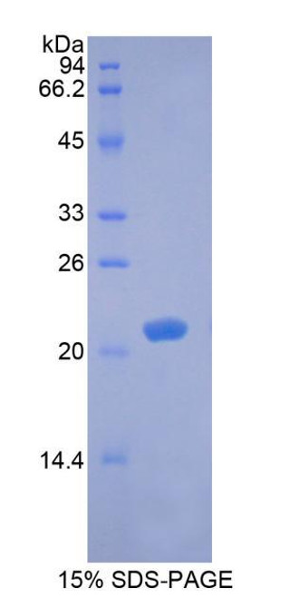 Rabbit Recombinant Brain Derived Neurotrophic Factor (BDNF)