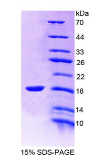 Rat Recombinant Bone Morphogenetic Protein Receptor 1A (BMPR1A)