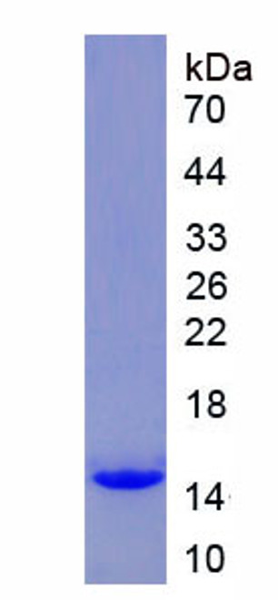 Mouse Recombinant Chemokine C-Motif Receptor 1 (XCR1)