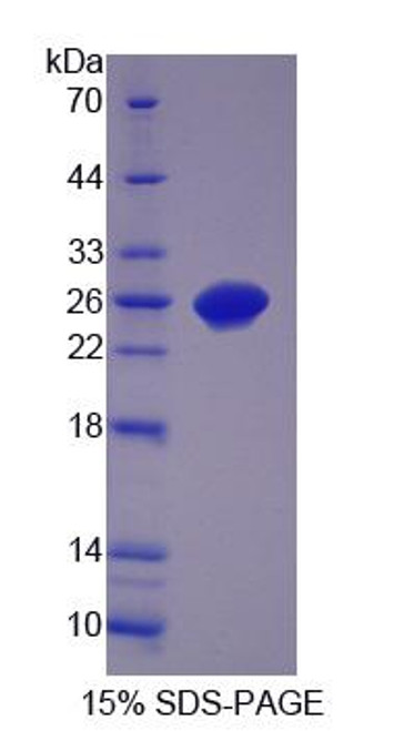 Pig Recombinant Ciliary Neurotrophic Factor (CNTF)