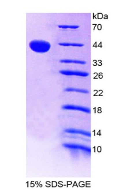 Human Recombinant Eosinophil Chemotactic Factor (ECF)