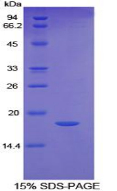 Human Recombinant Factor Related Apoptosis (FAS)