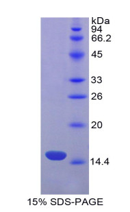 Human Recombinant Factor Related Apoptosis Ligand (FASL)