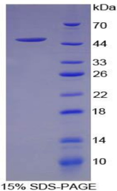 Pig Recombinant Fibroblast Growth Factor 1, Acidic (FGF1)