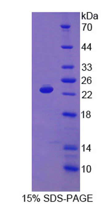 Sheep Recombinant Interferon Alpha (IFNa)