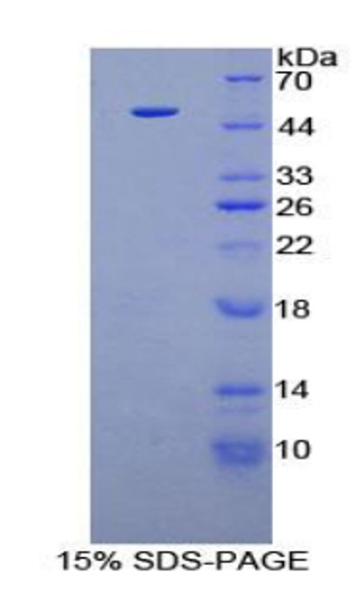 Human Recombinant Fibroblast Growth Factor 6 (FGF6)