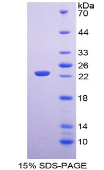 Mouse Recombinant Fibroblast Growth Factor 6 (FGF6)