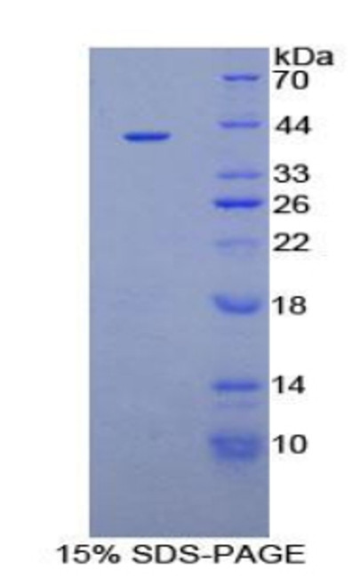 Human Recombinant Insulin Like Growth Factor Binding Protein 1 (IGFBP1)