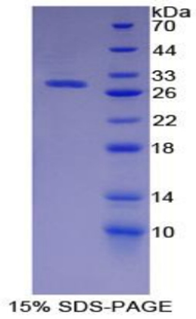 Pig Recombinant Insulin Like Growth Factor Binding Protein 4 (IGFBP4)