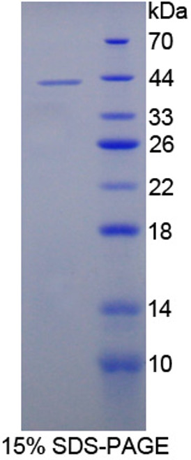 Rat Recombinant Interleukin 12B (IL12B)