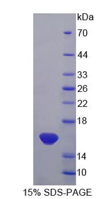 Rat Recombinant Interleukin 13 (IL13)