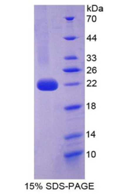 Mouse Recombinant Interleukin 1 Alpha (IL1a)