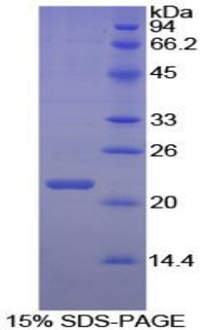 Chicken Recombinant Interleukin 2 (IL2)