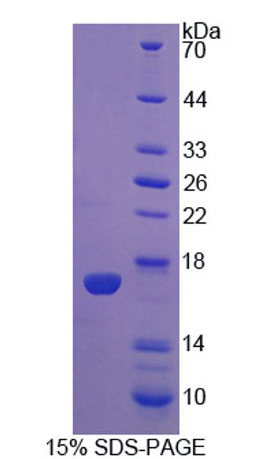 Pig Recombinant Interleukin 5 (IL5)