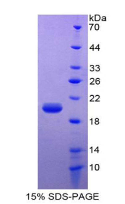 Rat Recombinant Leptin (LEP)