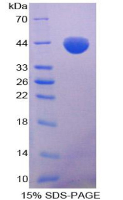 Pig Recombinant Microtubule Associated Protein Tau (MAPt)