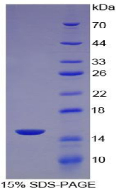 Human Recombinant Monocyte Chemotactic Protein 2 (MCP2)