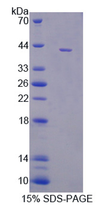 Pig Recombinant Monocyte Chemotactic Protein 2 (MCP2)