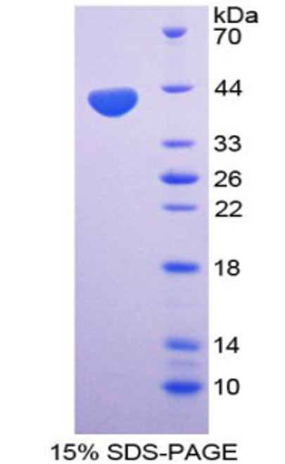 Human Recombinant Macrophage Inflammatory Protein 1 Beta (MIP1b)