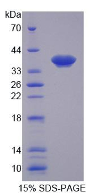 Rat Recombinant Matrix Metalloproteinase 1 (MMP1)