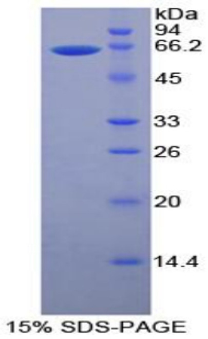 Human Recombinant Matrix Metalloproteinase 2 (MMP2)