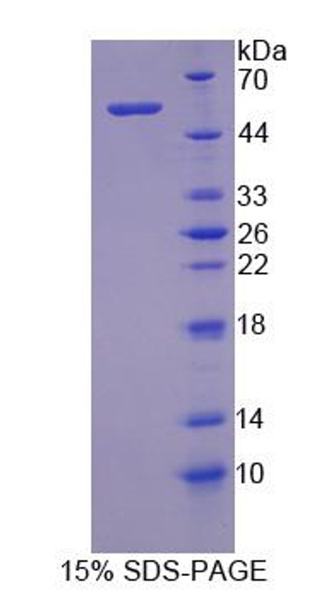 Pig Recombinant Matrix Metalloproteinase 3 (MMP3)